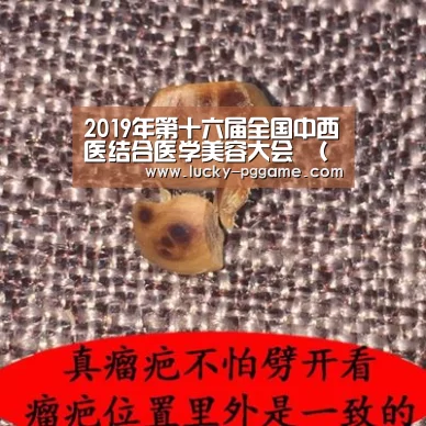 2019年第十六届全国中西医结合医学美容大会 (第二轮)会议通知【pg电子游戏】(图3) PG Soft